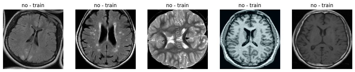 Tumor Track